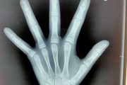 骨龄测算，科学与实践的深度探讨