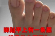 揭秘脚趾甲往上翘的算命奥秘，究竟预示着怎样的命运？
