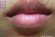 口角长痘解析，隐藏的健康与运势密码