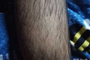 男子脱毛禁忌揭秘，这些事项不可忽视！