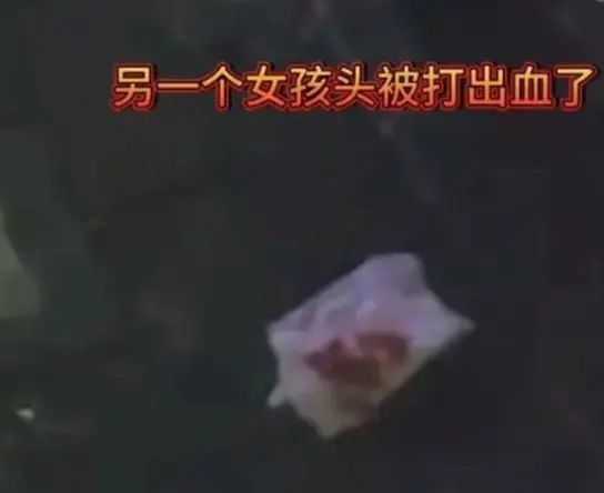 解梦流血，女性身体语言的隐秘警示,象征,解梦,健康状况,第1张