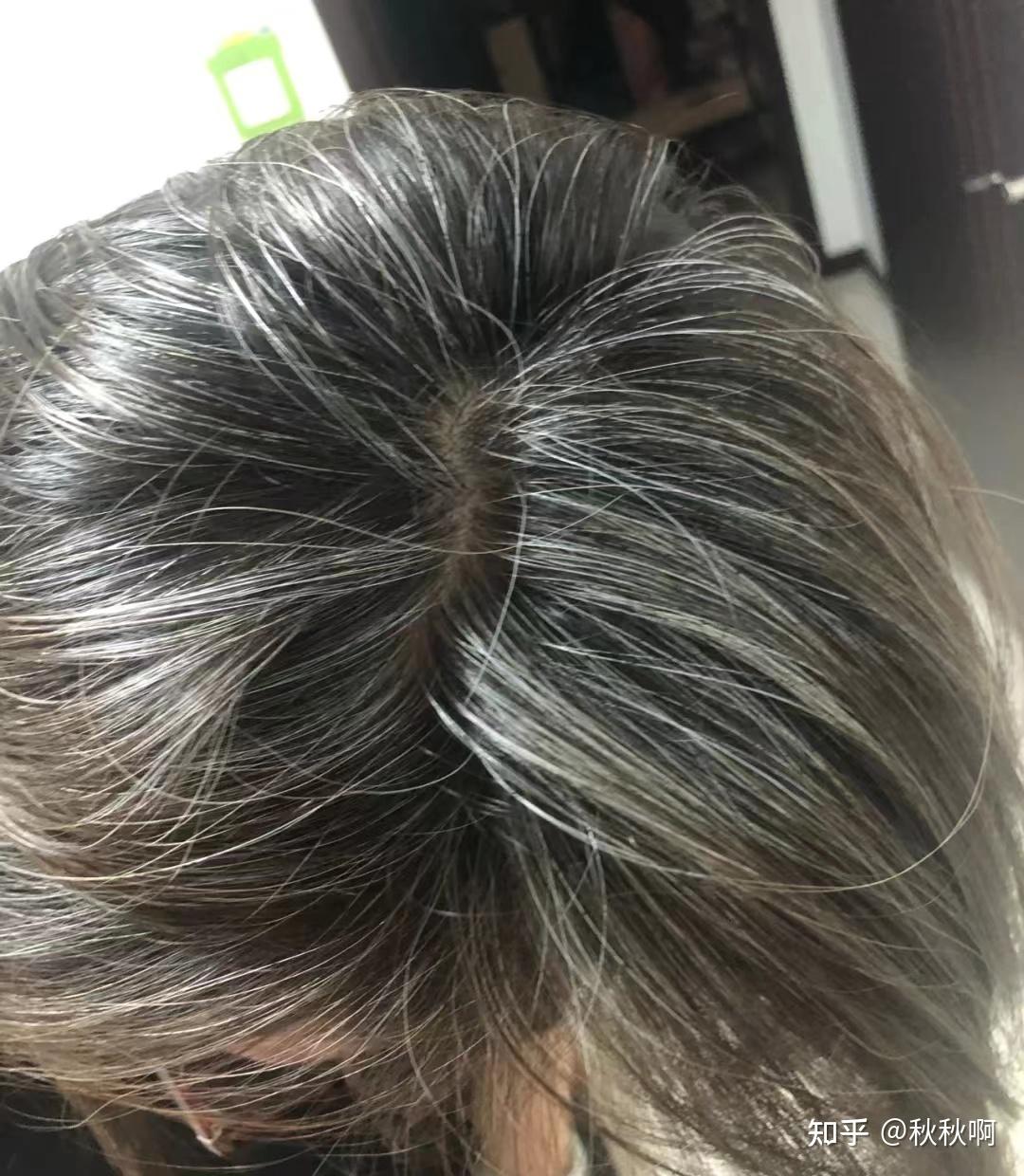 白发占卜,解读命运与健康的关键,象征,命运,自我,第1张 白发占卜,解读命运与健康的关键,象征,命运,自我,第1张