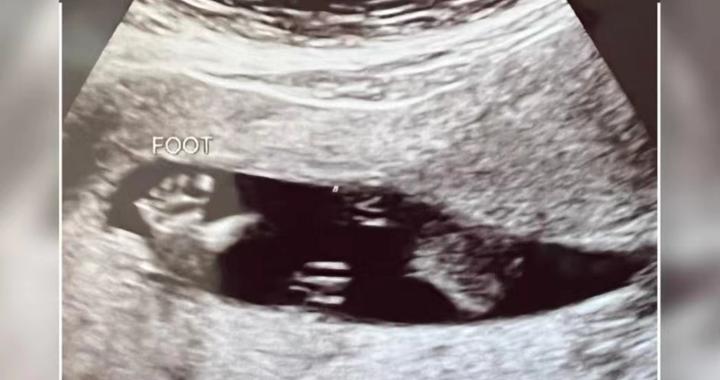 12月生孩子吉时，科学的孕期安排与分娩建议,吉时,第1张