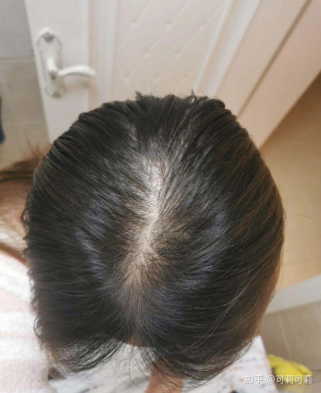 头顶上空一只老鹰，预兆与解梦的深层解析,象征,挑战,解梦,第1张