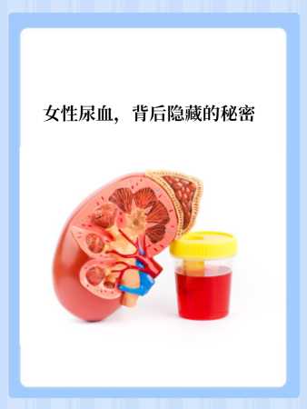 揭秘梦境,女性梦到尿血的含义与解析,象征,事业,挑战,第1张 揭秘梦境,女性梦到尿血的含义与解析,象征,事业,挑战,第1张